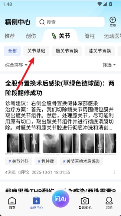 唯医骨科免费版下载 唯医骨科免费版下载