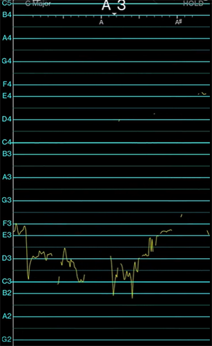 vocalpitchmonitor������